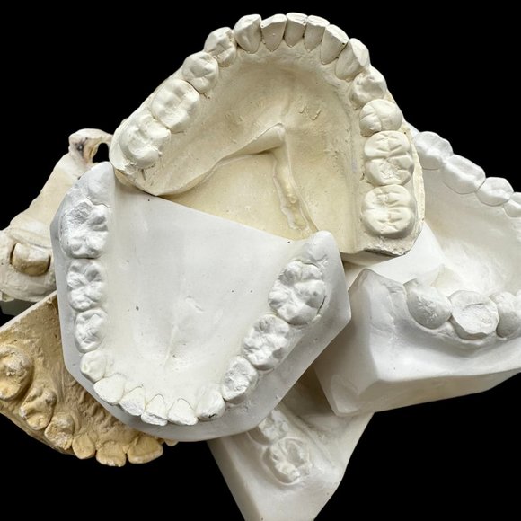 Vintage Plaster Dental Mold - Teeth Tooth Mold - Creepy Oddity - Dental Oddities - Picture 4 of 16